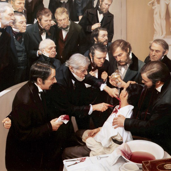 Painting of 19th century men in frock coats surrounding patient undergoing surgery