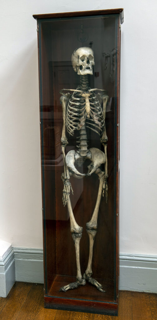 Skeleton in case